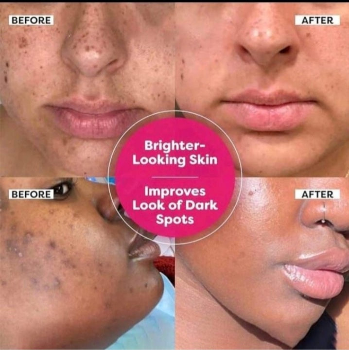 Dark Spot Correcting Glow Serum